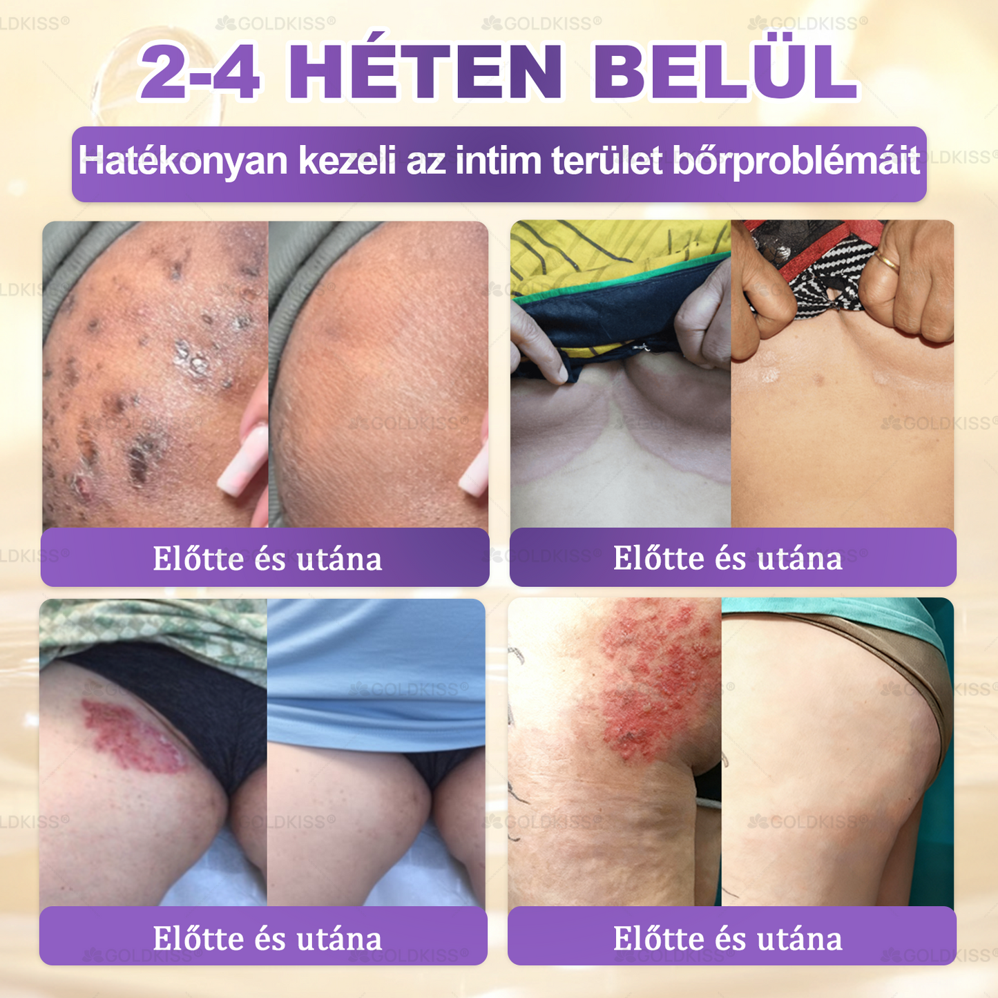Magyarországon gyártva és szállítva ✨ 𝐆𝐎𝐋𝐃𝐊𝐈𝐒𝐒® 𝐆𝐇𝐊-𝐂𝐮 & 𝐁𝐈𝐎𝐓𝐈𝐍 𝟏𝟎-𝐢𝐧-𝟏 Bőrmegújító Krém ⚡