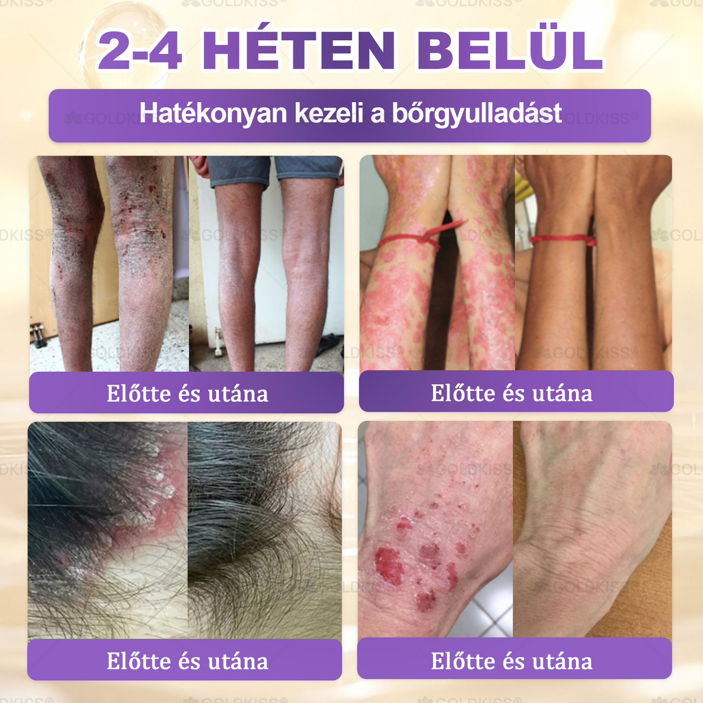 Magyarországon gyártva és szállítva ✨ 𝐆𝐎𝐋𝐃𝐊𝐈𝐒𝐒® 𝐆𝐇𝐊-𝐂𝐮 & 𝐁𝐈𝐎𝐓𝐈𝐍 𝟏𝟎-𝐢𝐧-𝟏 Bőrmegújító Krém ⚡