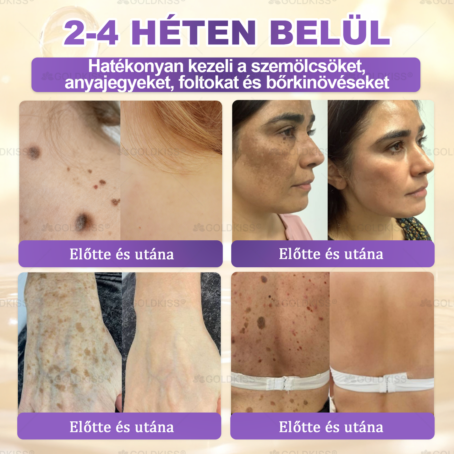 Magyarországon gyártva és szállítva ✨ 𝐆𝐎𝐋𝐃𝐊𝐈𝐒𝐒® 𝐆𝐇𝐊-𝐂𝐮 & 𝐁𝐈𝐎𝐓𝐈𝐍 𝟏𝟎-𝐢𝐧-𝟏 Bőrmegújító Krém ⚡