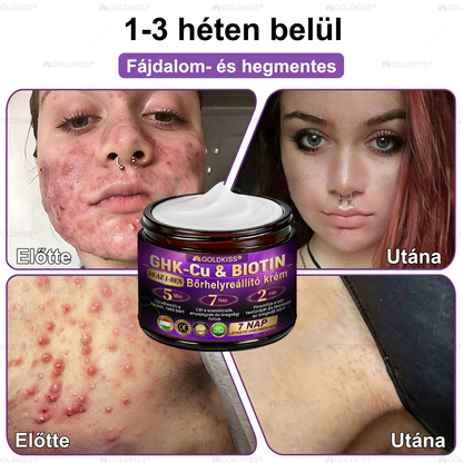 Magyarországon gyártva és szállítva ✨ 𝐆𝐎𝐋𝐃𝐊𝐈𝐒𝐒® 𝐆𝐇𝐊-𝐂𝐮 & 𝐁𝐈𝐎𝐓𝐈𝐍 𝟏𝟎-𝐢𝐧-𝟏 Bőrmegújító Krém ⚡