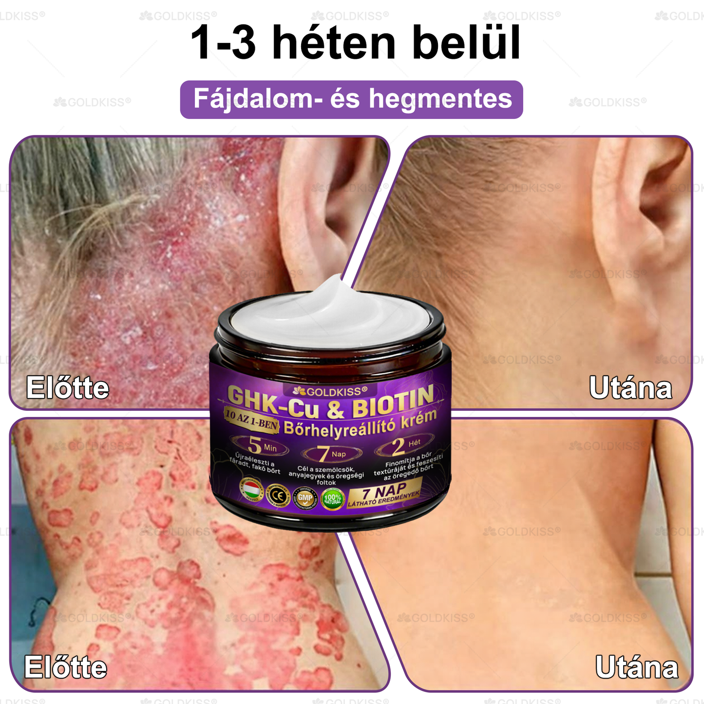 Magyarországon gyártva és szállítva ✨ 𝐆𝐎𝐋𝐃𝐊𝐈𝐒𝐒® 𝐆𝐇𝐊-𝐂𝐮 & 𝐁𝐈𝐎𝐓𝐈𝐍 𝟏𝟎-𝐢𝐧-𝟏 Bőrmegújító Krém ⚡
