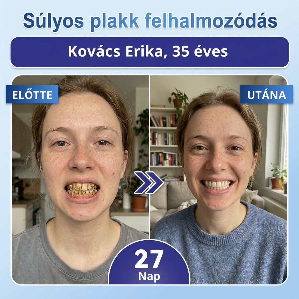 🇭🇺🦷 Mondj búcsút az érzékenységnek és kellemetlenségeknek! 𝐂𝐨𝐚𝐮𝐨𝐨® Tideglusib szájcsíkok – gyors regenerálás a fogaknak és az ínynek 😊