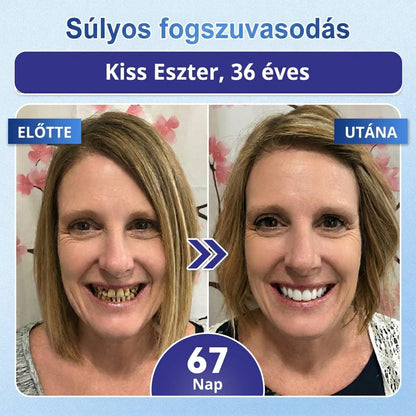🇭🇺🦷 Mondj búcsút az érzékenységnek és kellemetlenségeknek! 𝐂𝐨𝐚𝐮𝐨𝐨® Tideglusib szájcsíkok – gyors regenerálás a fogaknak és az ínynek 😊